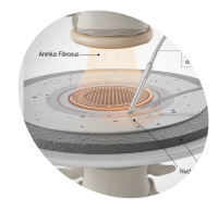 terapie-infusionale-spinali